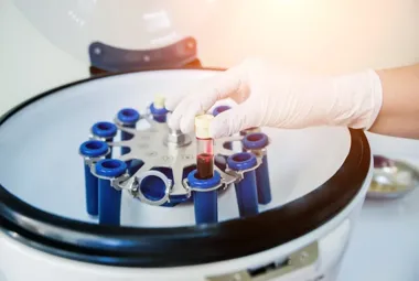 W jakich dziedzinach nauki i przemysłu wykorzystuje się wirówki laboratoryjne?